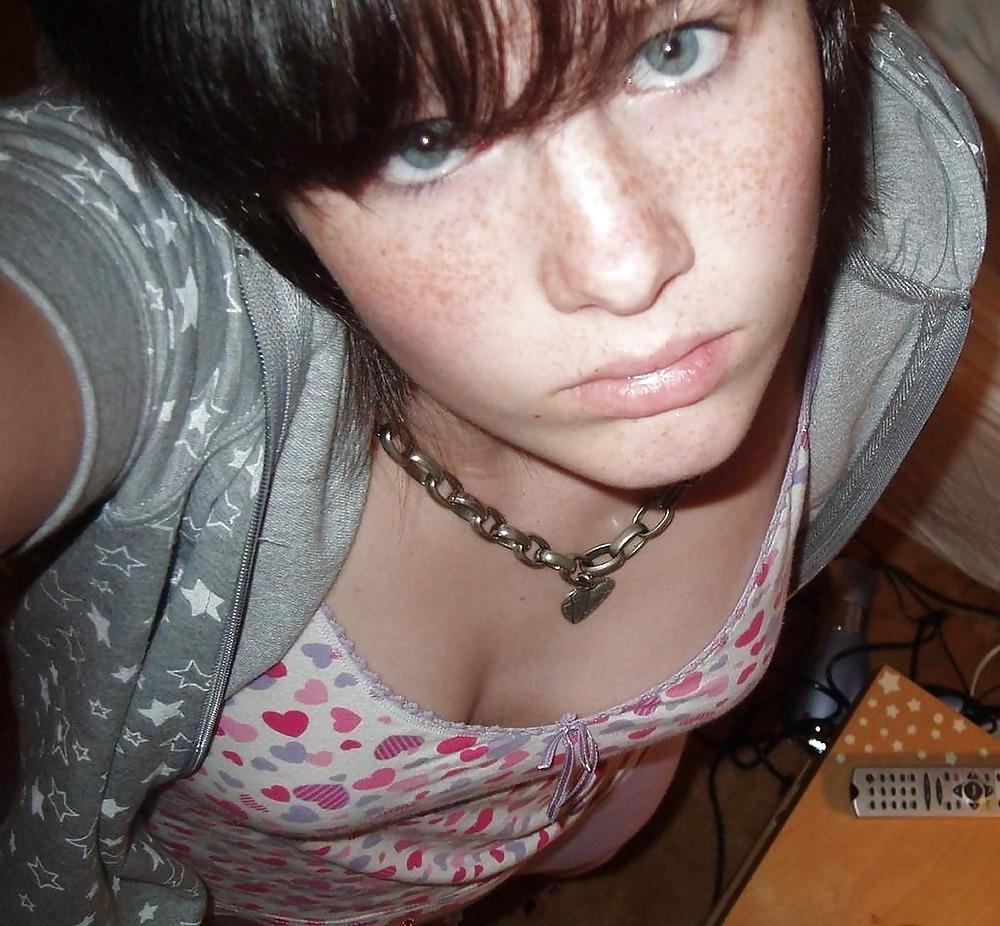 15P Freckled Teens