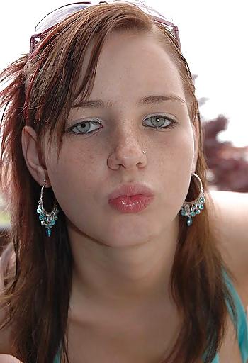 15P Freckled Teens
