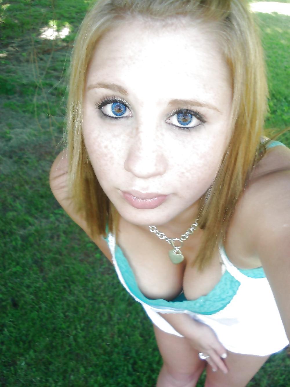 25P Freckles Love Them 3