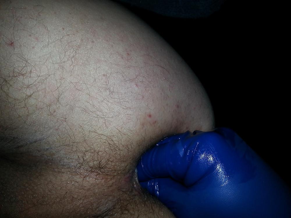9P Blue Latex Gloves anal fun