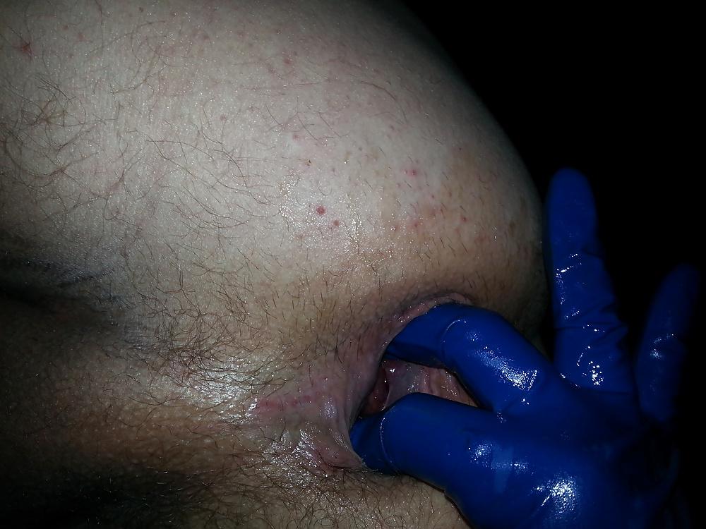 9P Blue Latex Gloves anal fun