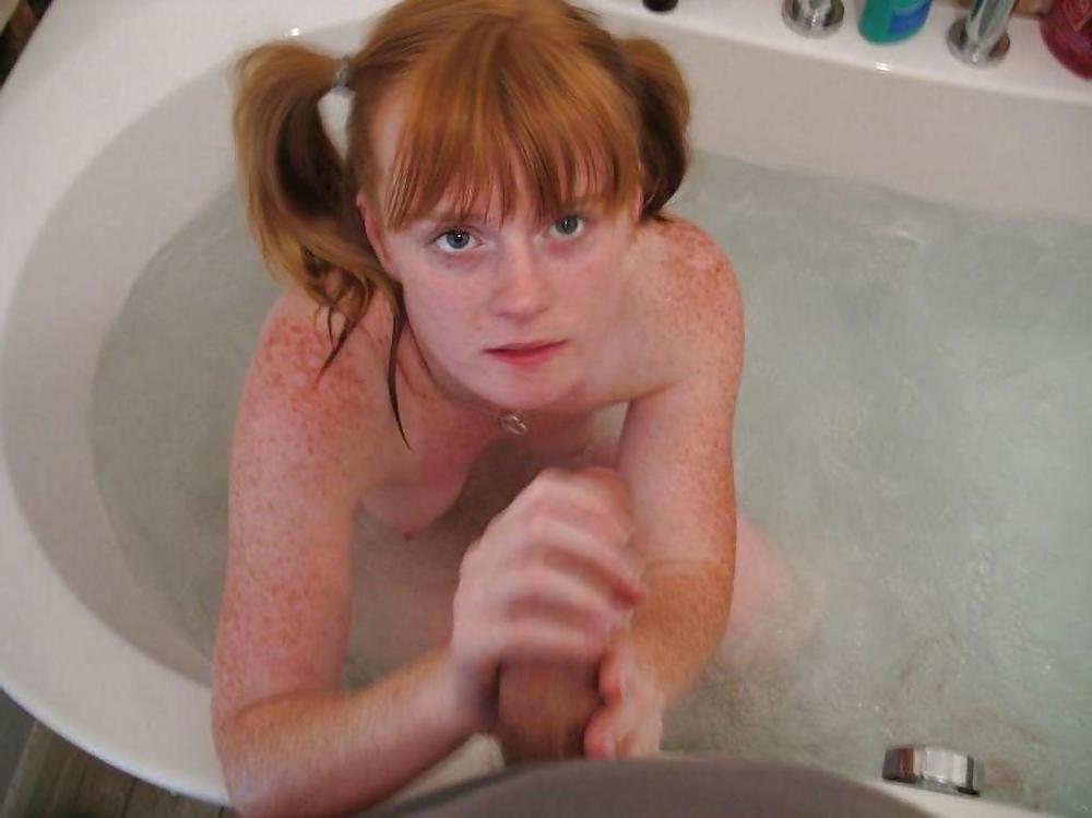 25P FRECKLED REDHEAD