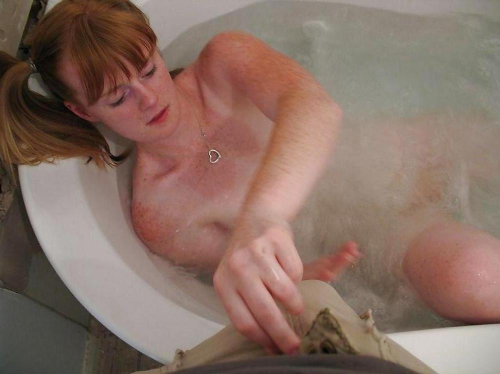25P FRECKLED REDHEAD