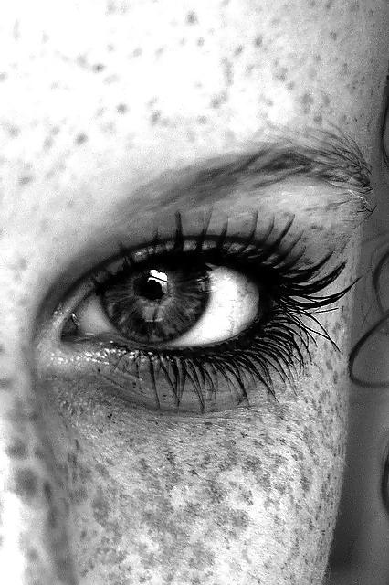 25P Just freckles....