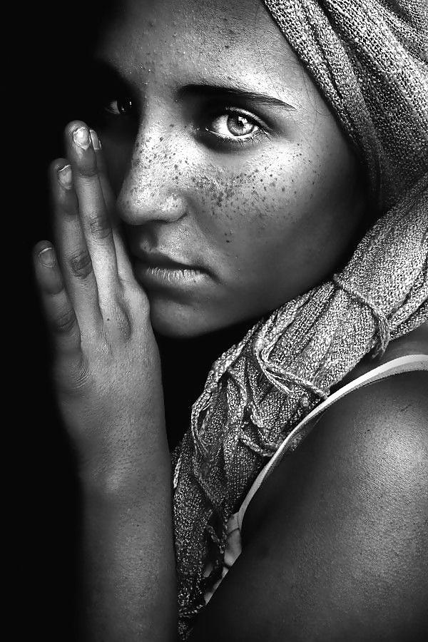 25P Just freckles....