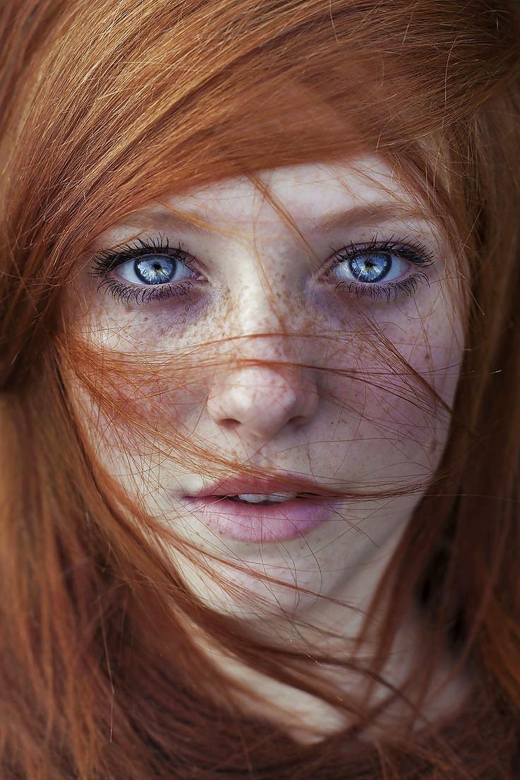 25P Just freckles....