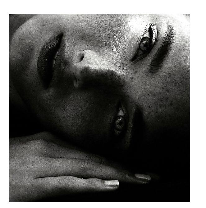25P Just freckles....