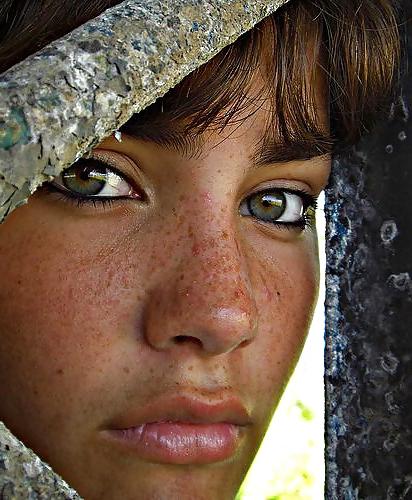 25P Just freckles....