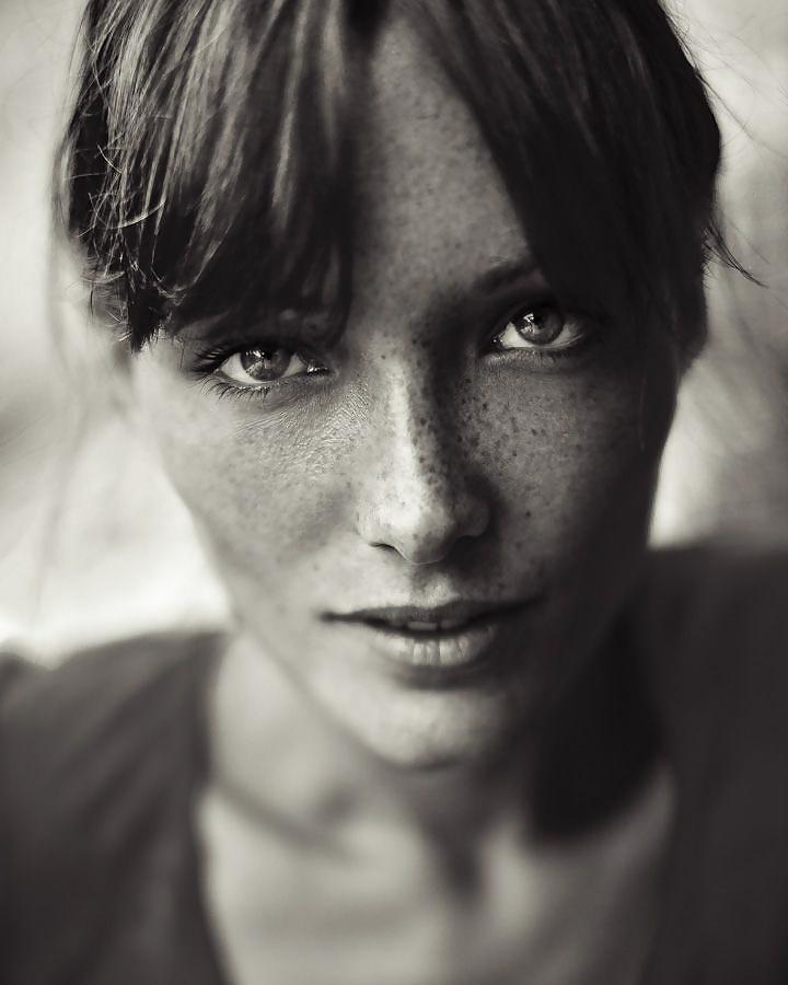 25P Just freckles....
