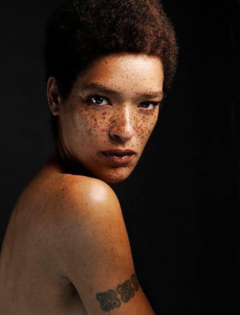 25P Just freckles....