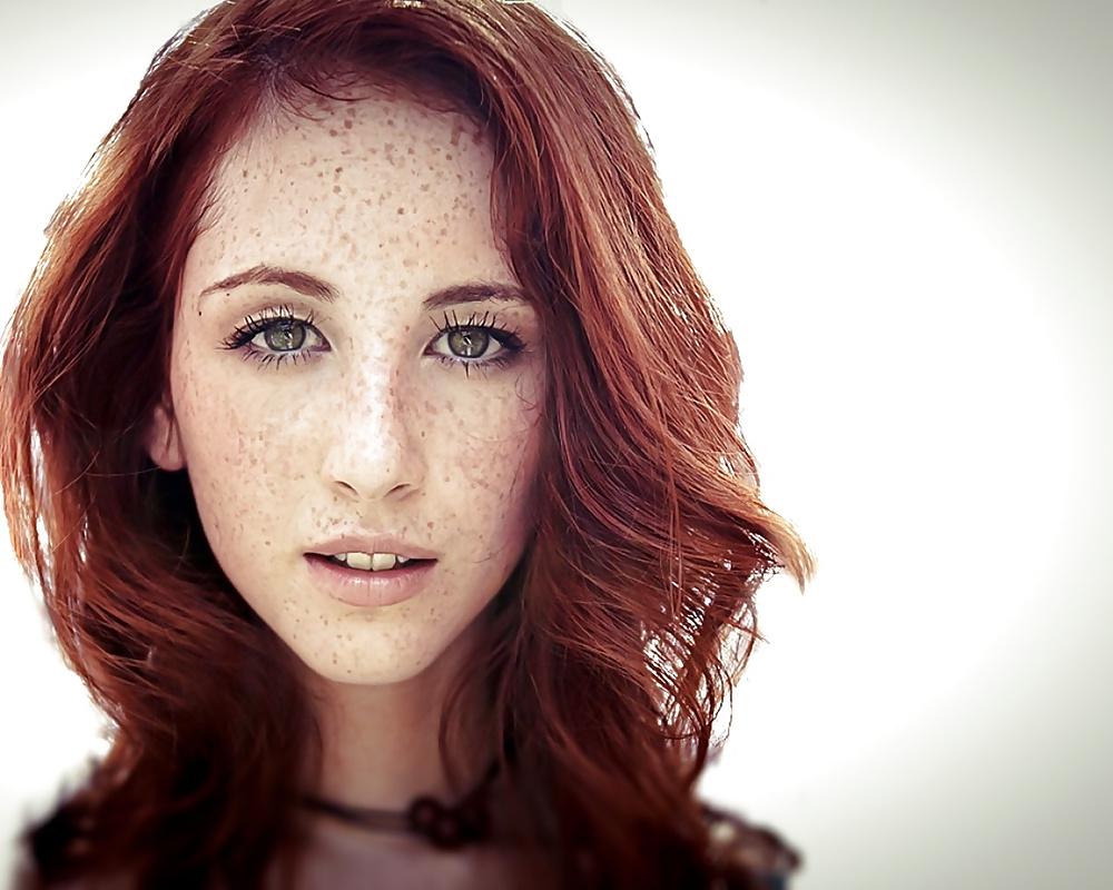 25P Oh My God I Love Freckles!!!