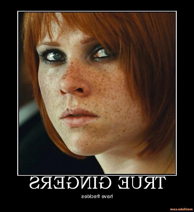 25P Oh My God I Love Freckles!!!