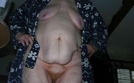 11P Granny wrinkled body. My weakness1