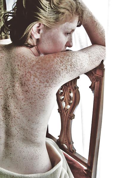 22P Freckles!