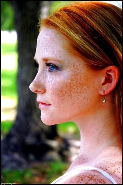 22P Freckles!