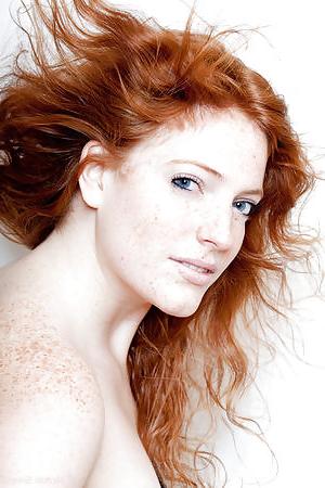 22P Freckles!