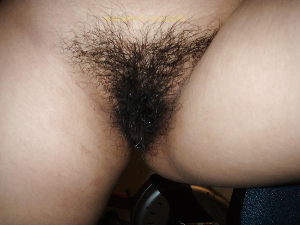 17P Pubes Forest - JothaHele