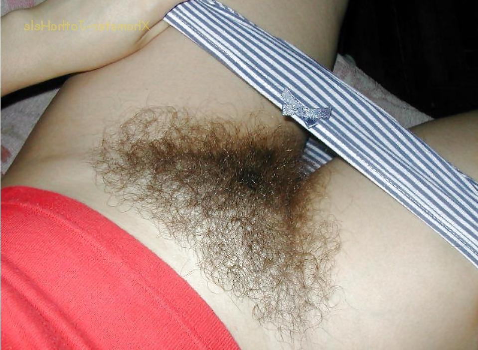 17P Pubes Forest - JothaHele