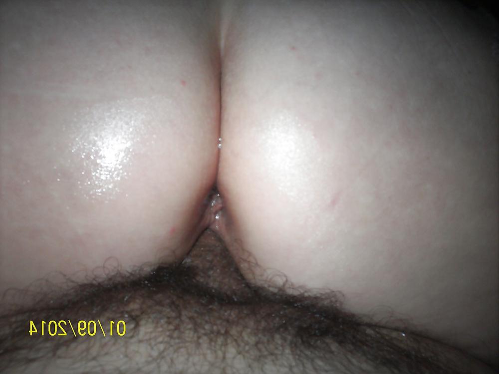 22P Oral, vaginal y anal