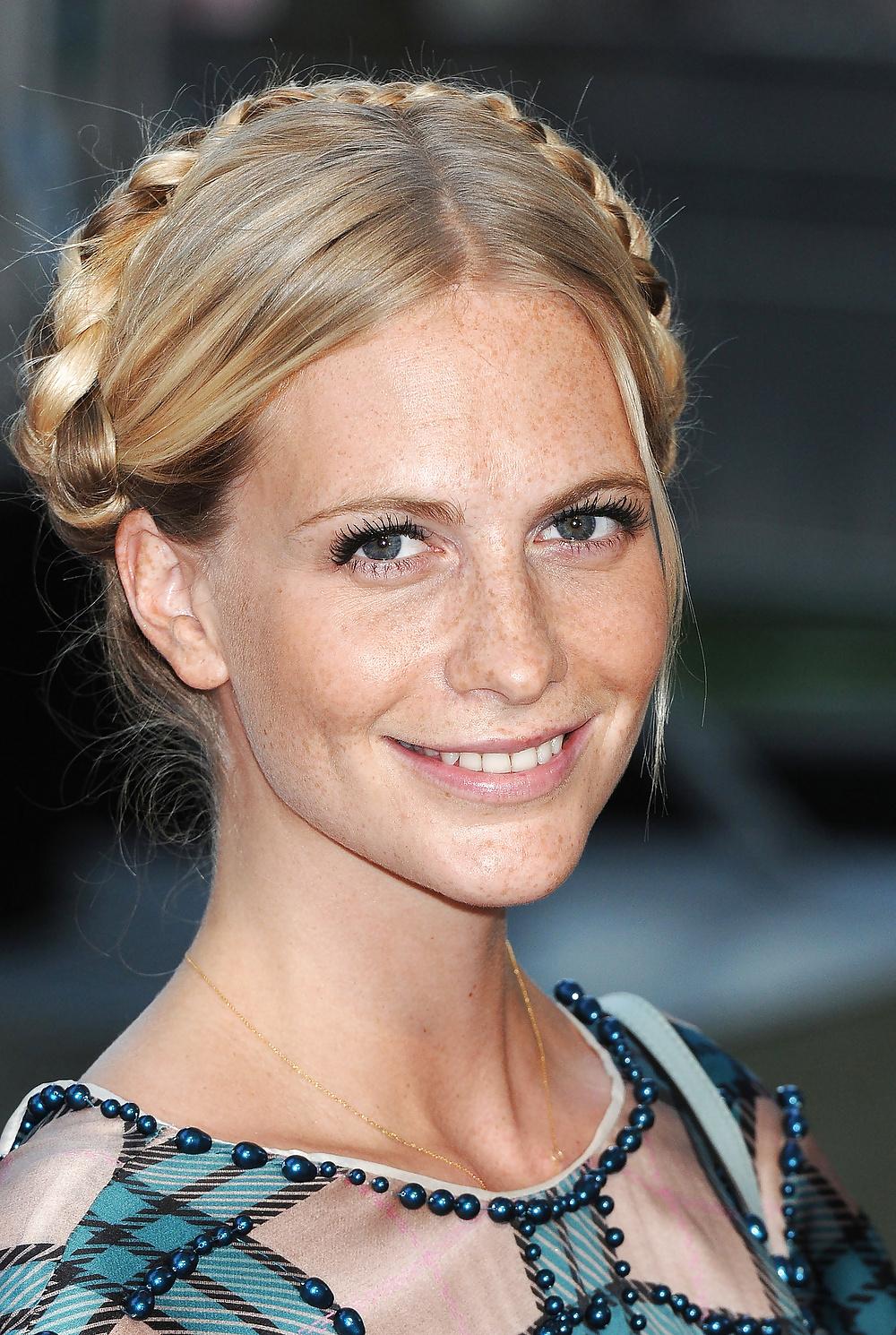 13P Lovely  Freckles