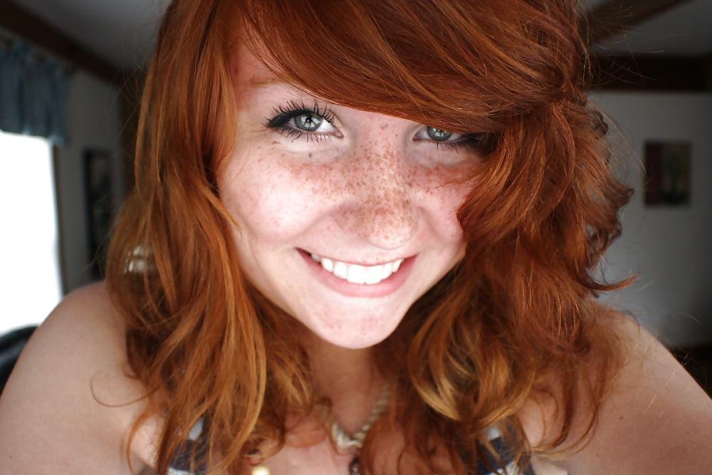 13P Lovely  Freckles