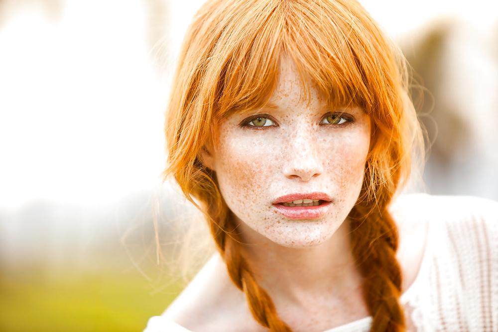 13P Lovely  Freckles