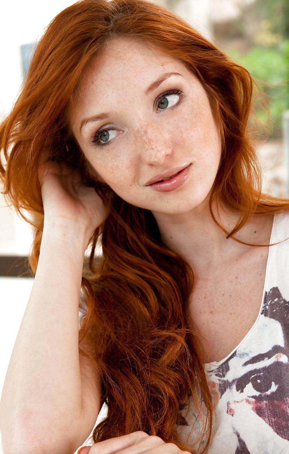 13P Lovely  Freckles