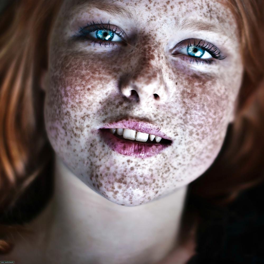 13P Lovely  Freckles