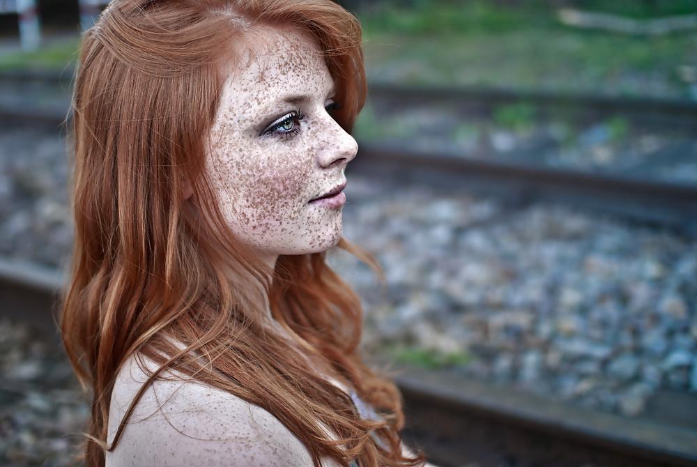 13P Lovely  Freckles