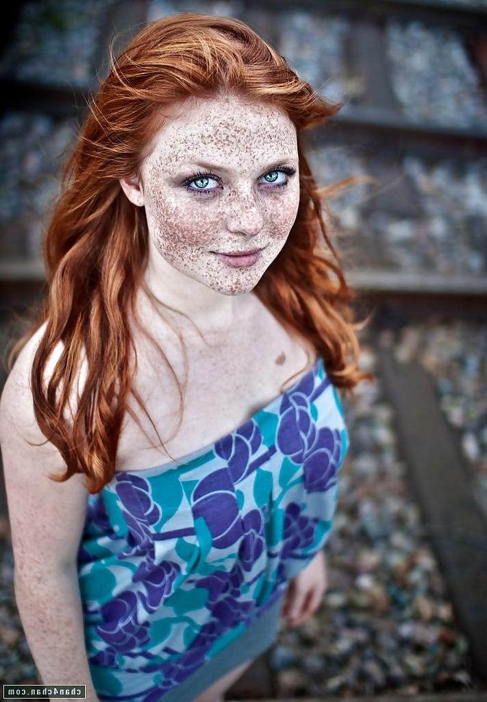 13P Lovely  Freckles