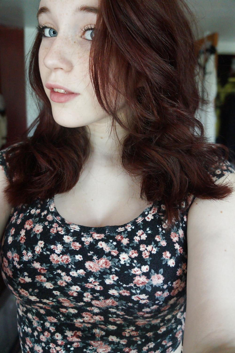 23P More Freckled 