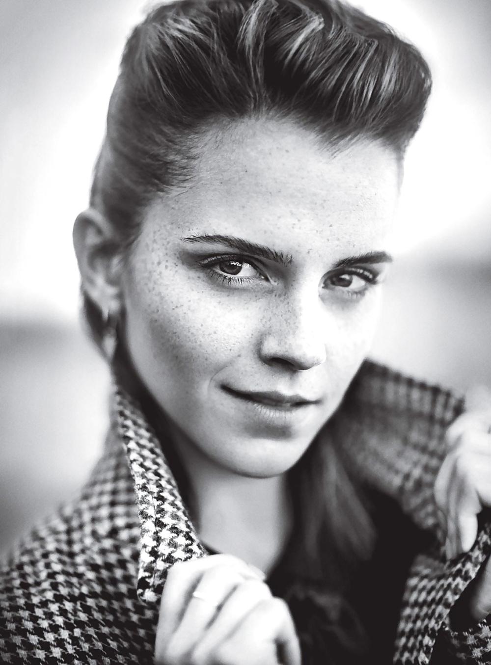 7P Emma Watson Freckles - Teen Vogue August 2013