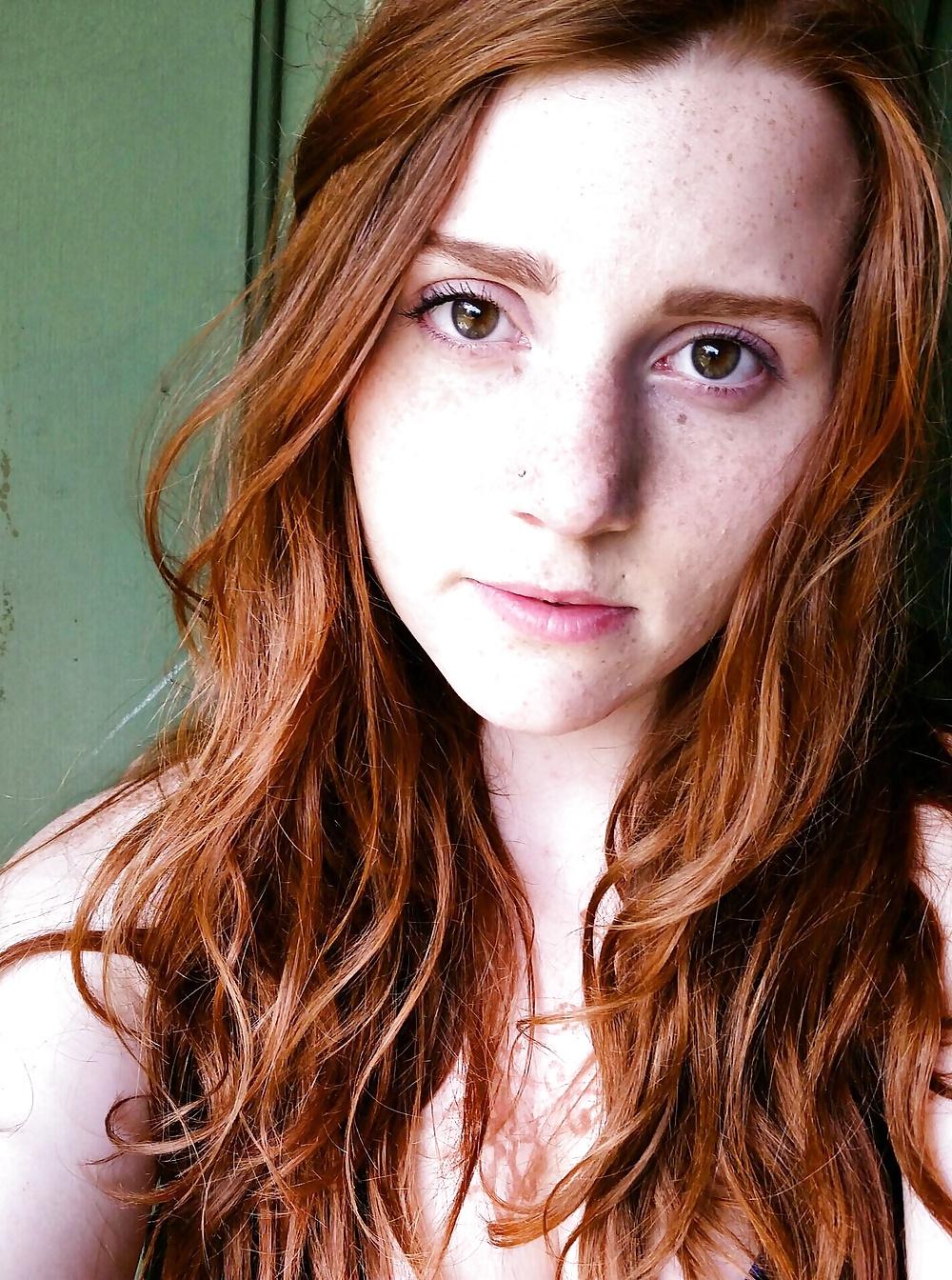 24P Freckled girls
