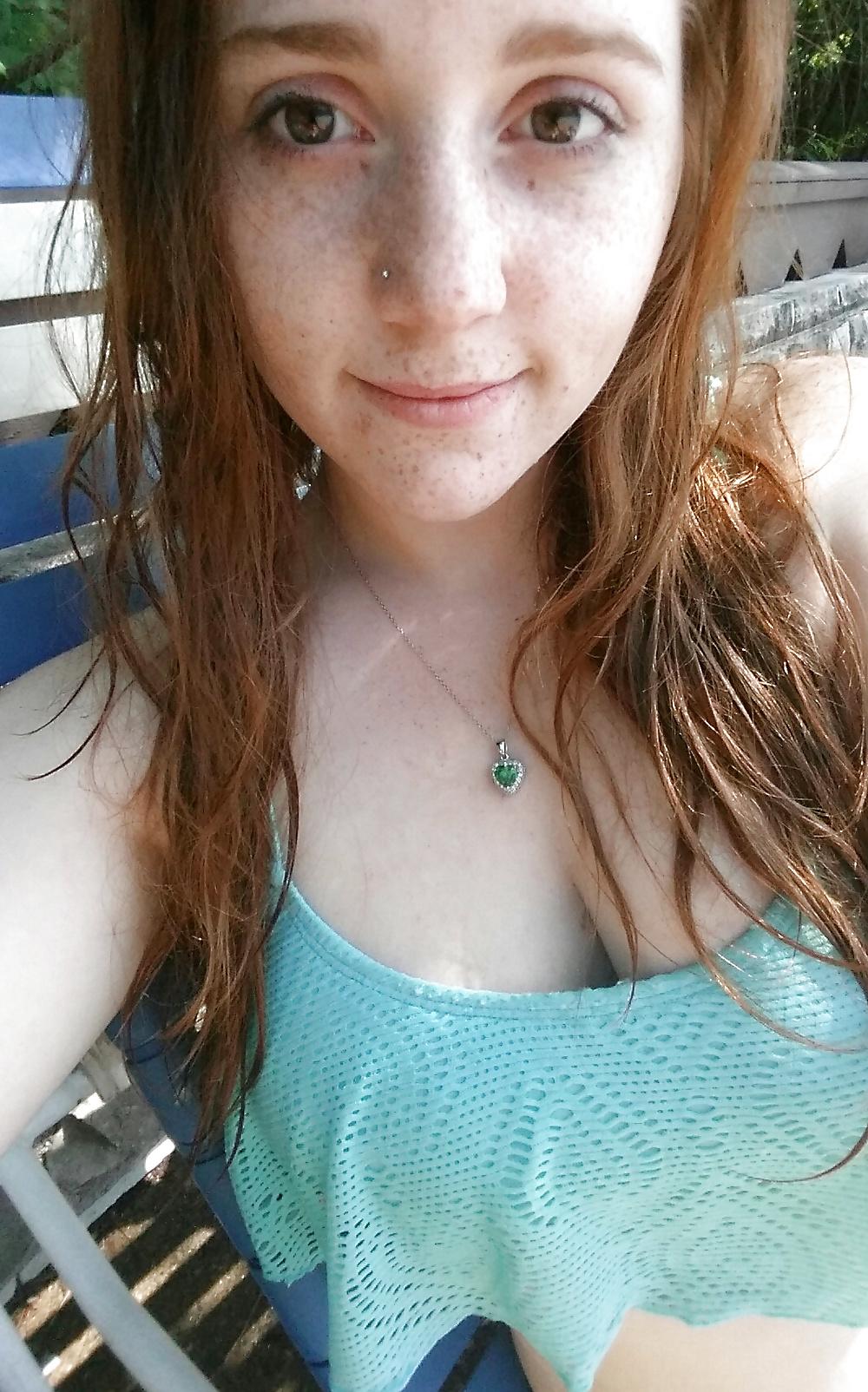 24P Freckled girls