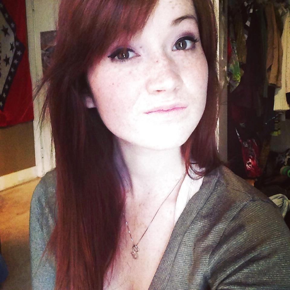 24P Freckled girls