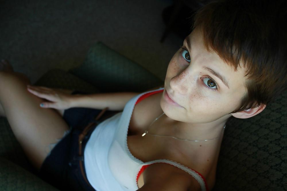 24P Freckled girls