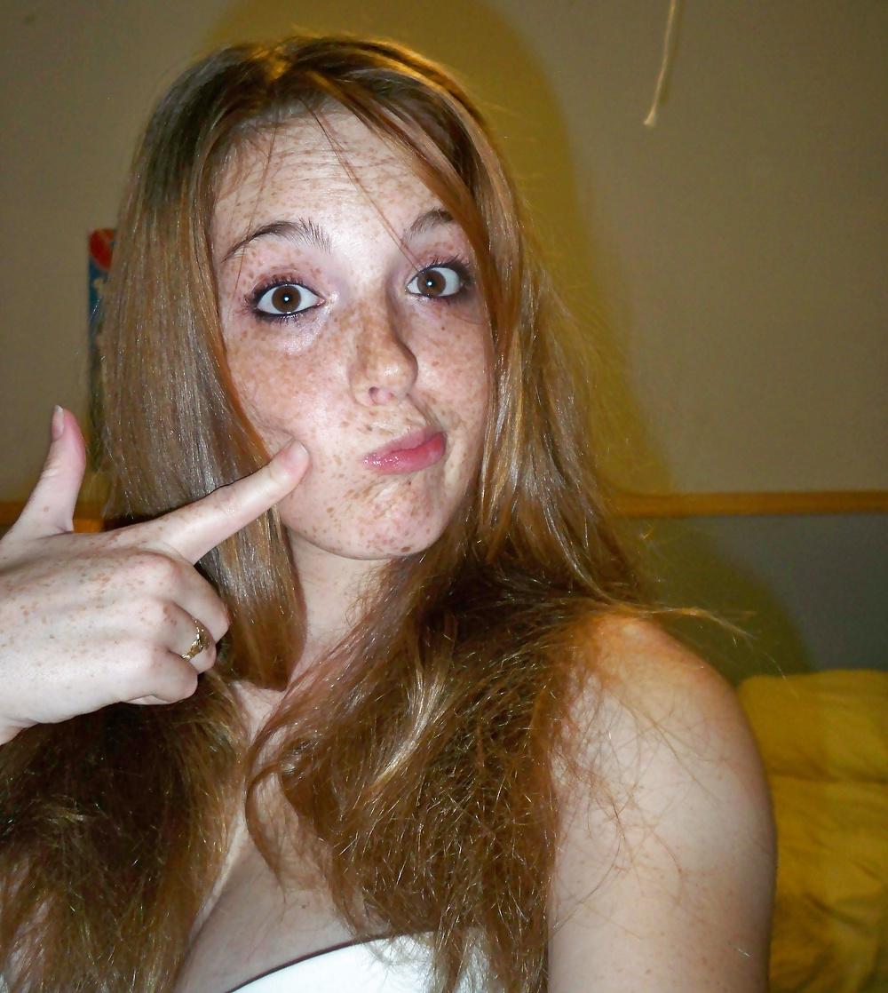 24P Freckled girls
