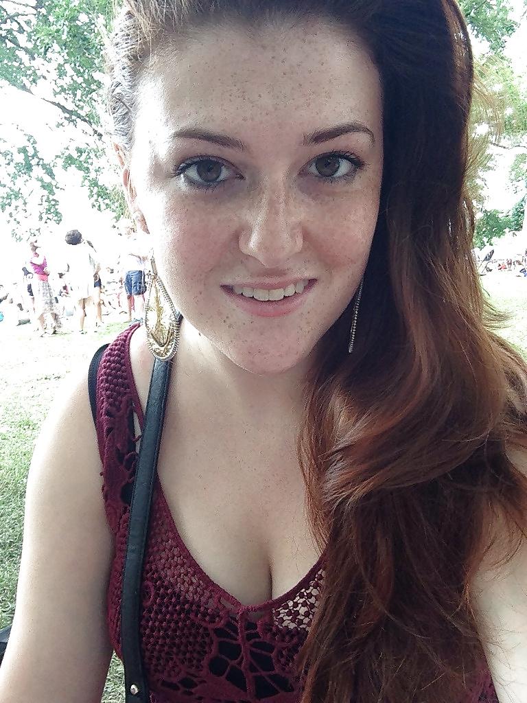 24P Freckled girls