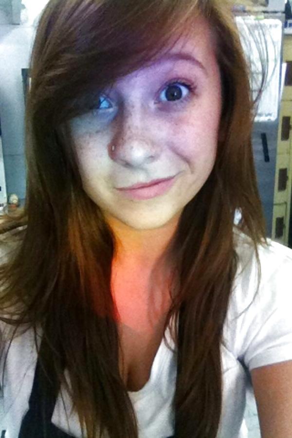 24P Freckled girls