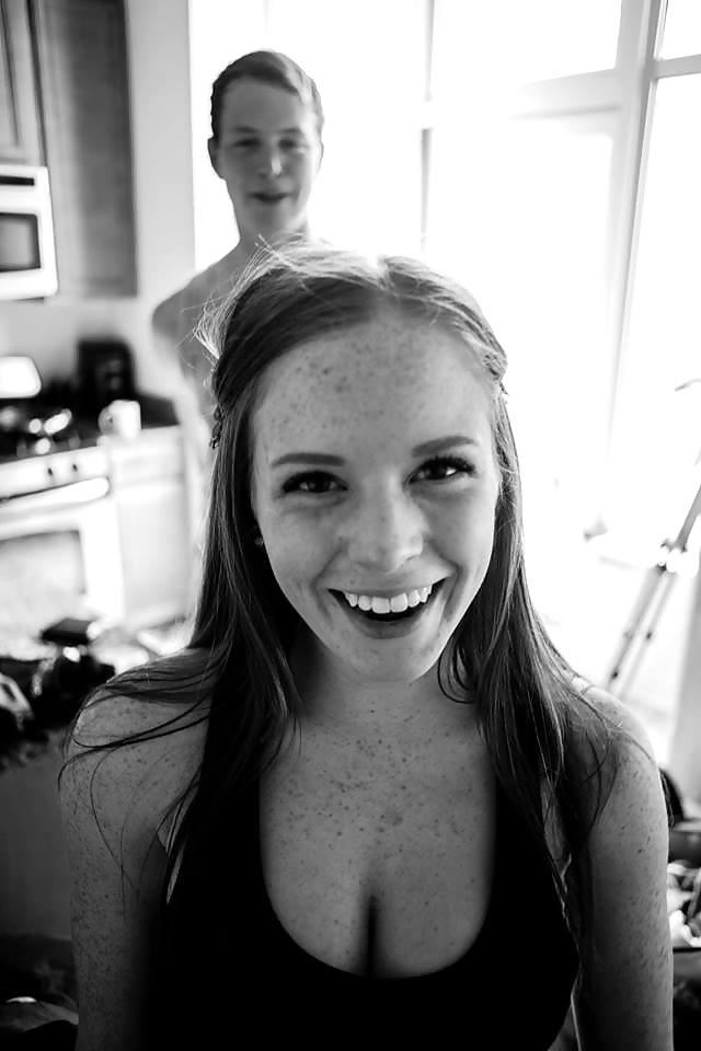 24P Freckled girls