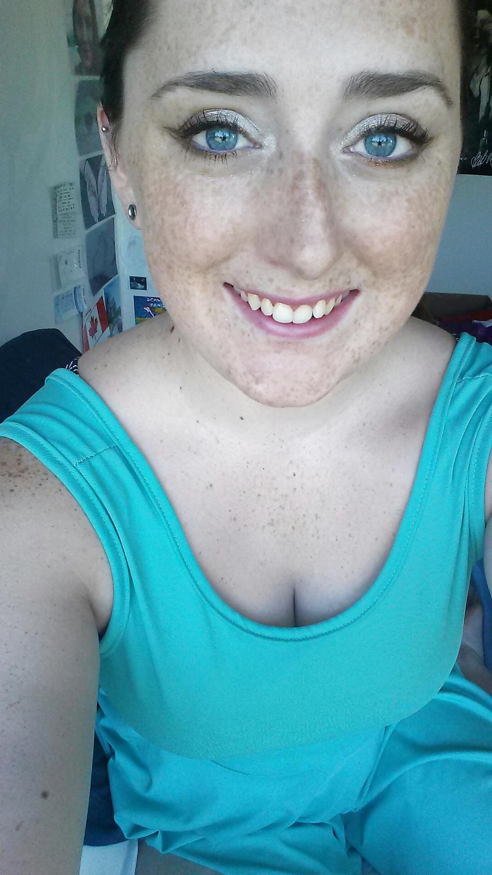 24P Freckled girls