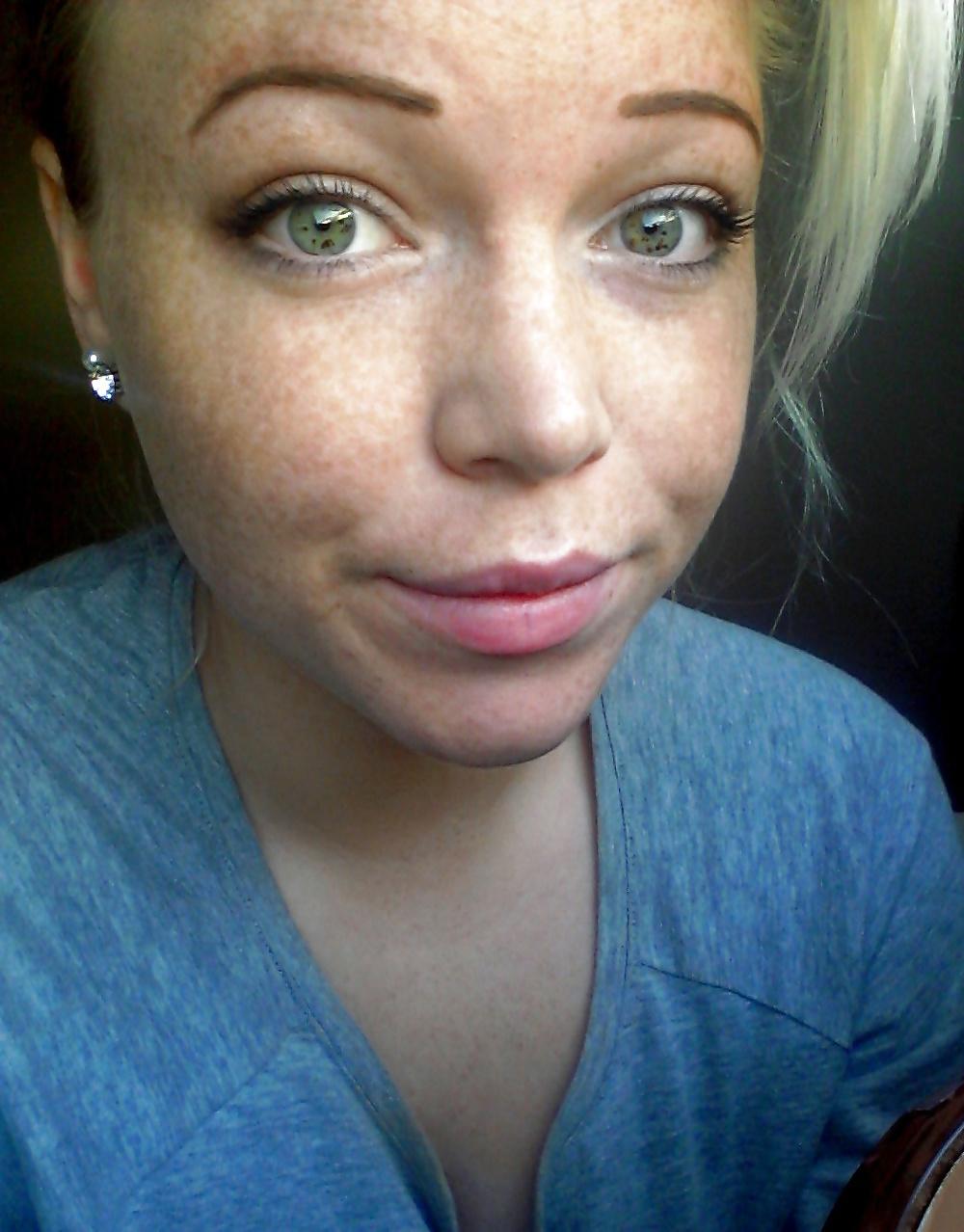 24P Freckled girls