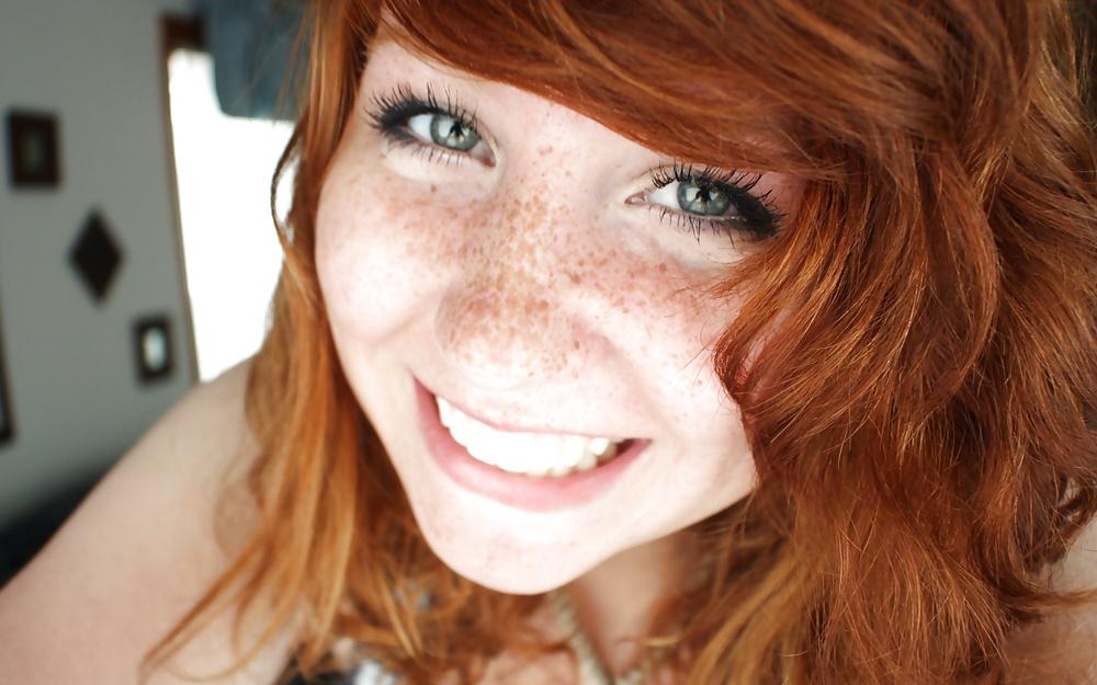 24P Freckled girls
