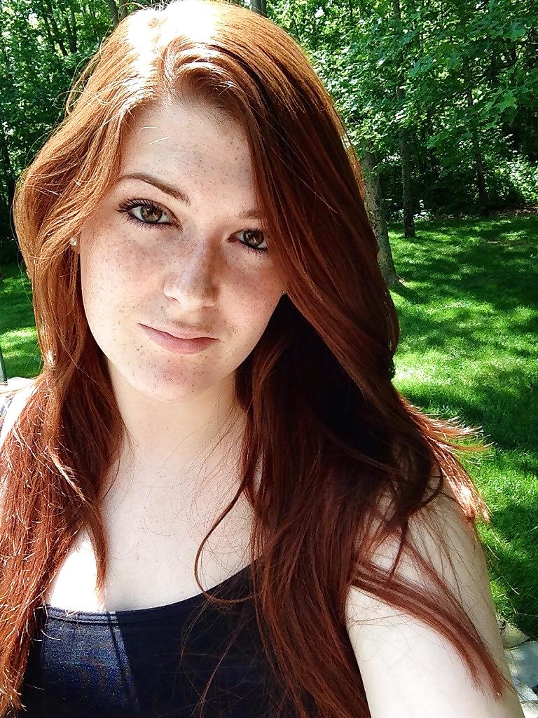 24P Freckled girls