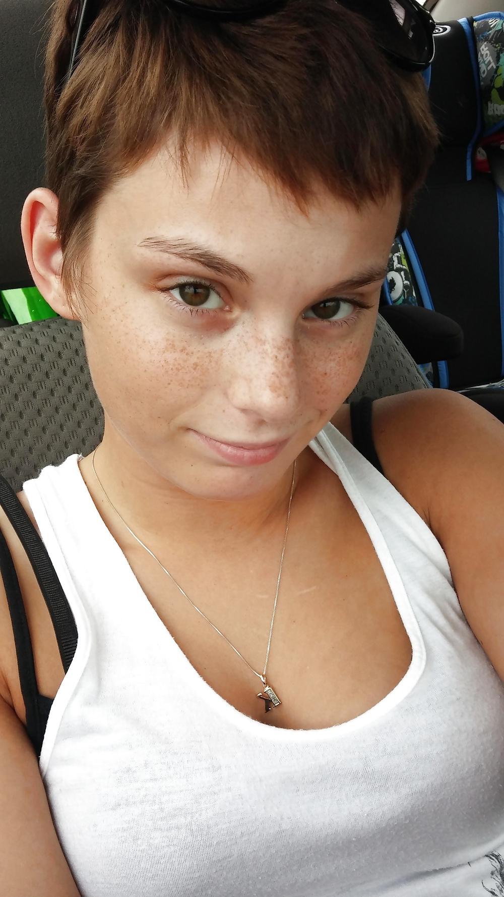 24P Freckled girls