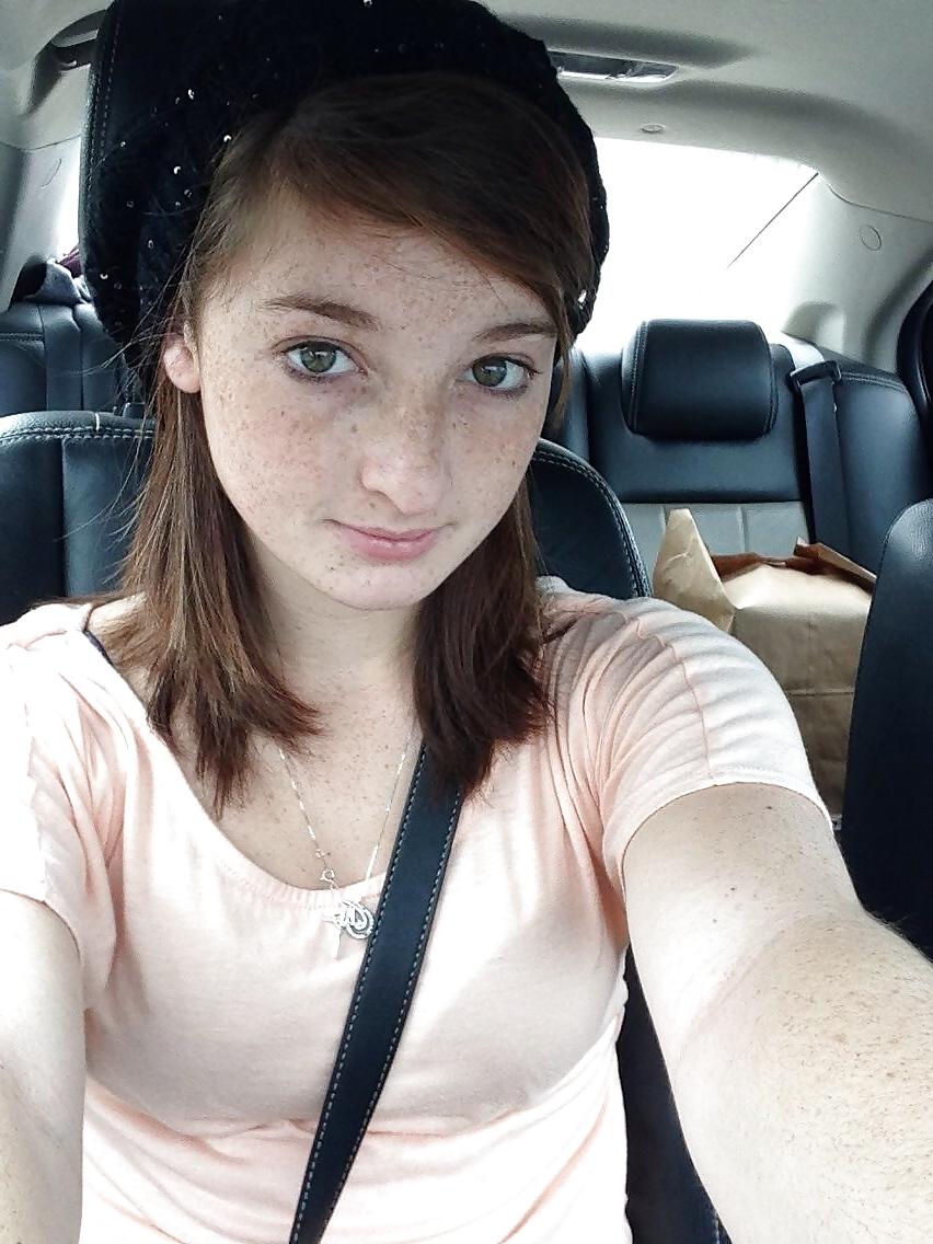 24P Freckled girls