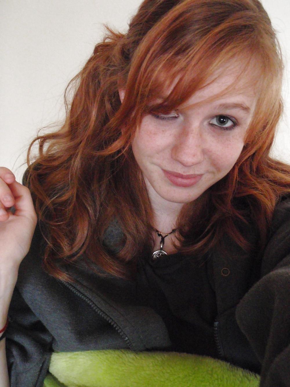 24P Freckled girls