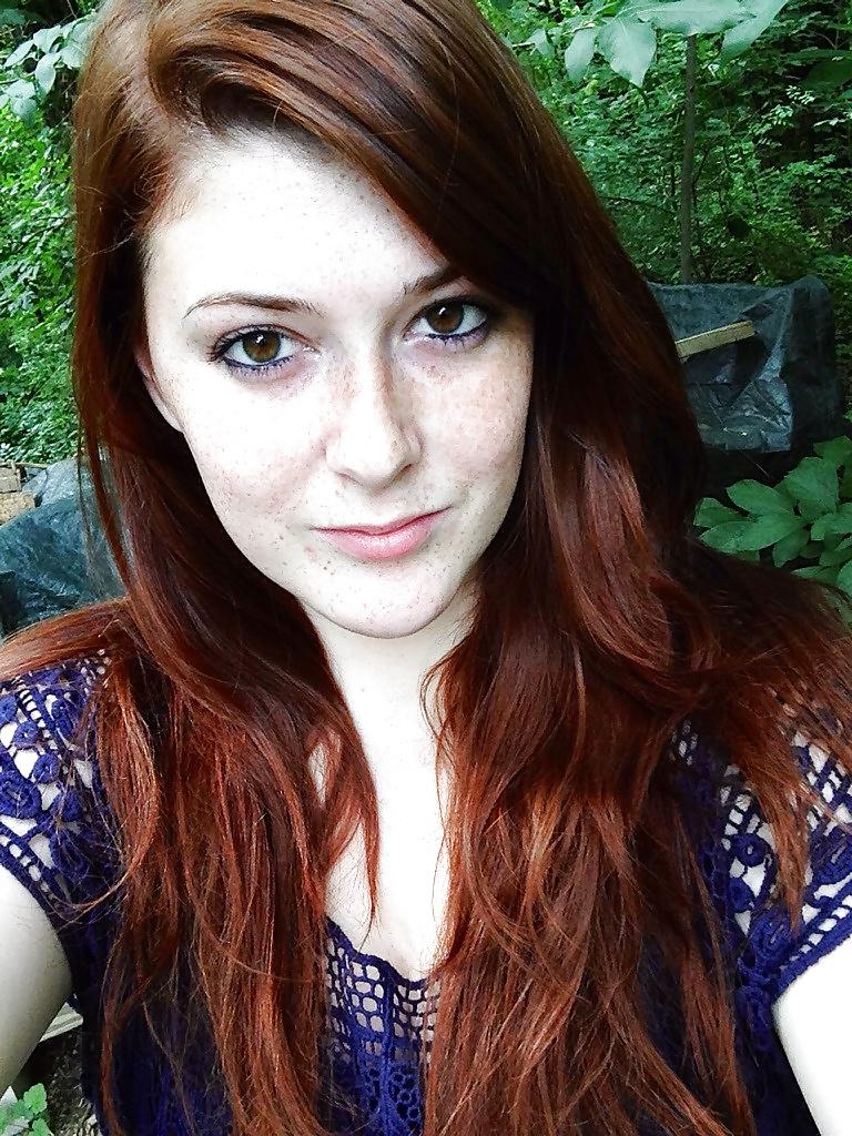 24P Freckled girls