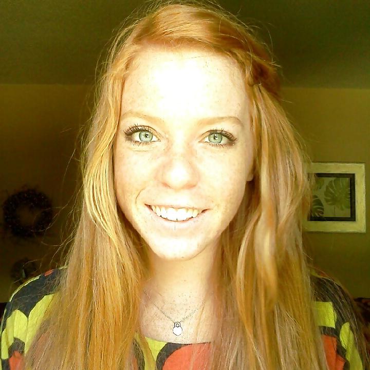 24P Freckled girls