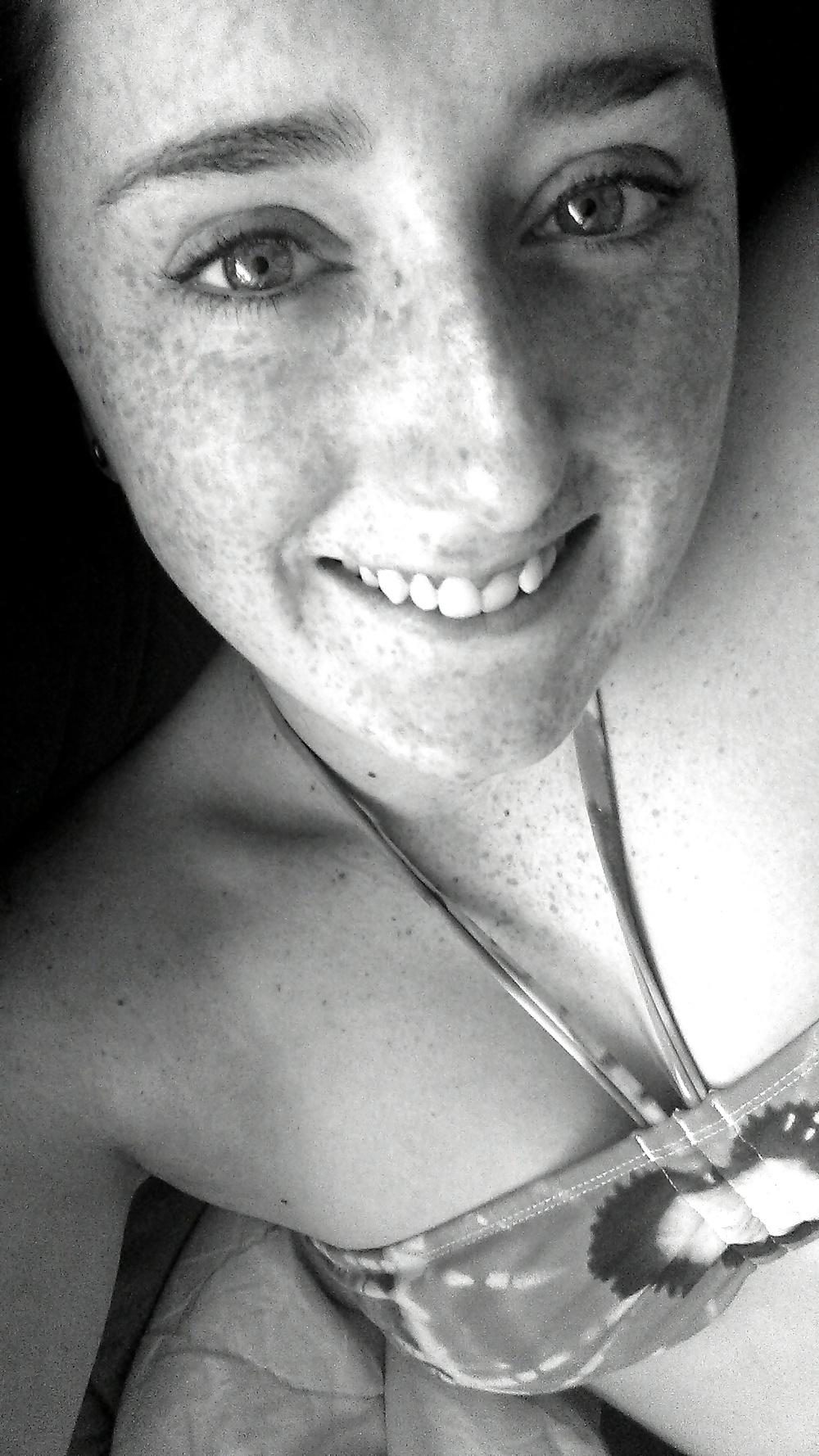 24P Freckled girls